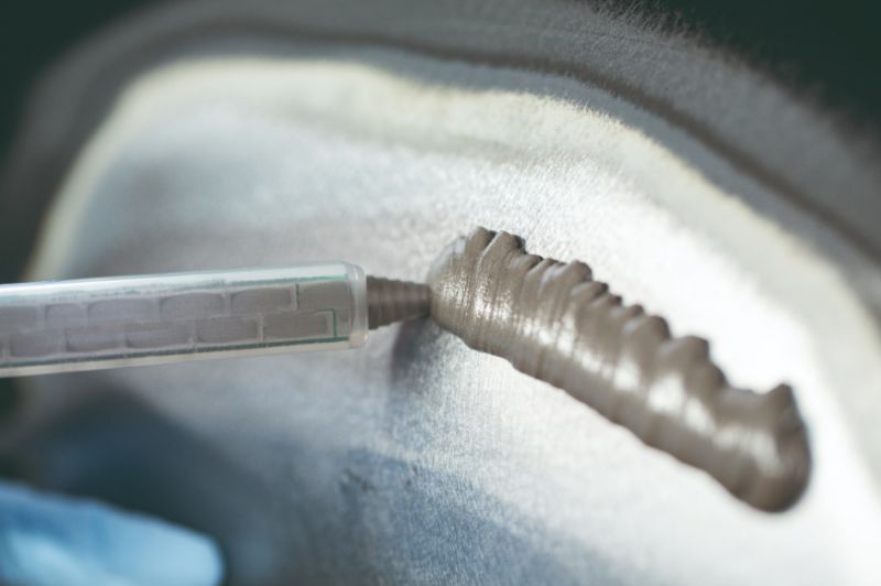  Kaltverformt? Kaltrepariert!